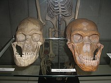 Надбровья и глазницы современного человека (слева) как правило угловатые и «домиком»