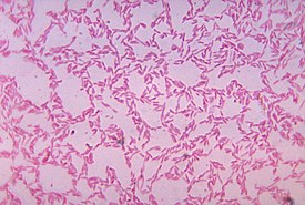 Bacteroides biacutis, мазок по Граму 48-часовой культуры, выращенной на кровяном агаре