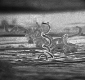 Бледная трепонема (Treponema pallidum), вызывающая сифилис