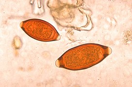 Яйца нематод под оптическим микроскопом (меньшее — Trichuris vulpis, большее — власоглав)