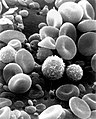 Обычная циркулирующая кровь человека под сканирующим электронным микроскопом. Видно эритроциты, несколько видов лейкоцитов (лимфоциты, моноциты и нейтрофил) и много тромбоцитов в форме мелких дисков.