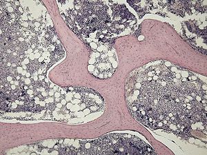 Микрофотография губчатого вещества, демонстрирующая его трабекулы (розовые) и мозговое вещество (синее).