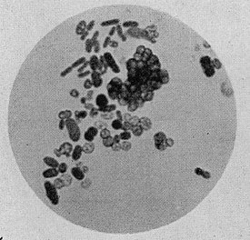 Клетки представителей рода Azotobacter: видны палочковидные и кокковидные клетки различного размера. Окраска железным гематоксилином по Гейденгайну; ×1000