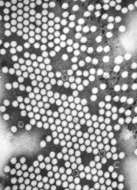 Электронная микрофотография вируса полиомиелита