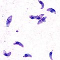 Токсоплазма (Toxoplasma gondii) — самый распространённый паразит-простейшее, который может попадать в организм человека через пищевые продукты (животного происхождения). Вызывает токсоплазмоз, который приводит к тератогенному эффекту (уродства), олигофрении, поражениям нервной системы или гибели плода, у взрослых в острой форме протекает подобно брюшному тифу, с увеличением некоторых внутренних органов (печени, селезёнки), температурой или с поражением нервной системы, может протекать и бессимптомно. Токсоплазмы также обладают свойствами влиять на сознание организма носителя.[источник не указан 221 день]