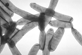 Микрофотография L. pneumophila, полученная способом трансмиссионной электронной микроскопии