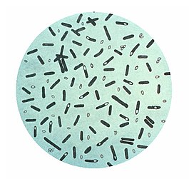 Clostridium botulinum (окраска генциановым фиолетовым) — возбудитель ботулизма