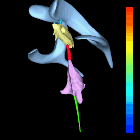 Вращающееся трёхмерное изображение четырёх желудочков мозга и их соединений между собой. Сверху вниз: Синий — боковые желудочки Голубой — отверстие Монро Жёлтый — третий желудочек Красный — сильвиев водопровод Фиолетовый — четвёртый желудочек Зелёный — переход в центральный спинномозговой канал (отверстия, соединяющие желудочковую систему мозга с субарахноидальным пространством, на схеме не видны).