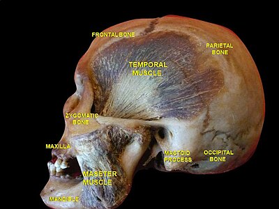 Теменная кость с височной фасцией и мышцей