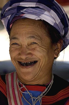 Почерневшие от жевания бетеля зубы у женщины из национальных меньшинств Таиланда