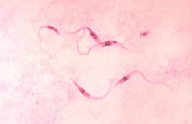 Трипаносомы в крови пациента, поражённого болезнью Шагаса