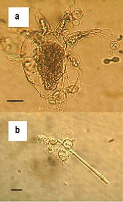 Зооспорангии Batrachochytrium dendrobatidis на пресноводном рачке (a) и на водоросли (b)