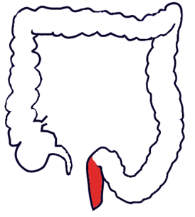 Прямая кишка толстого кишечника обозначена красным
