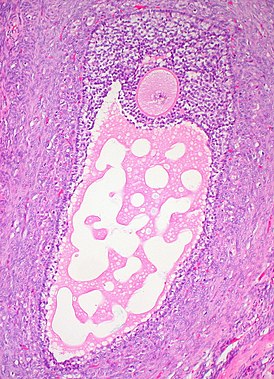 Гистологический срез зрелого фолликула яичника. Ооцит — большая, круглая, розово окрашенная клетка в верхней части изображения.