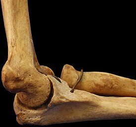 Кости локтевого сустава