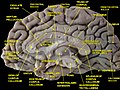 Медиальная поверхность полушария головного мозга