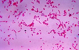 Fusobacterium novum