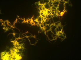 Mycobacterium tuberculosis