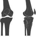 Передний и латеральный вид колена.