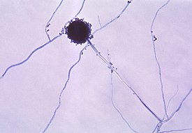 Конидий у Aspergillus niger